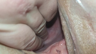 Huge stretched pussy (cervix visible)